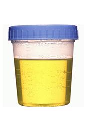 Busted For Bizarre Bid To Game Urine Test