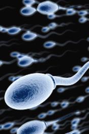 Sperm