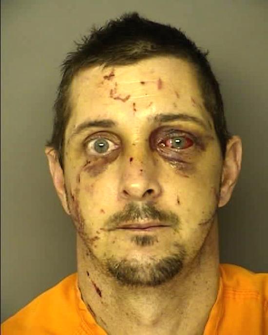 His mugshot looks like he kissed a chain linked fence rather than concrete....